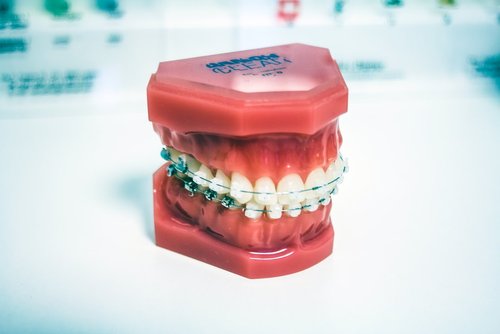 HOW TO KNOW IF YOU ARE A GOOD CANDIDATE FOR ADULT BRACES