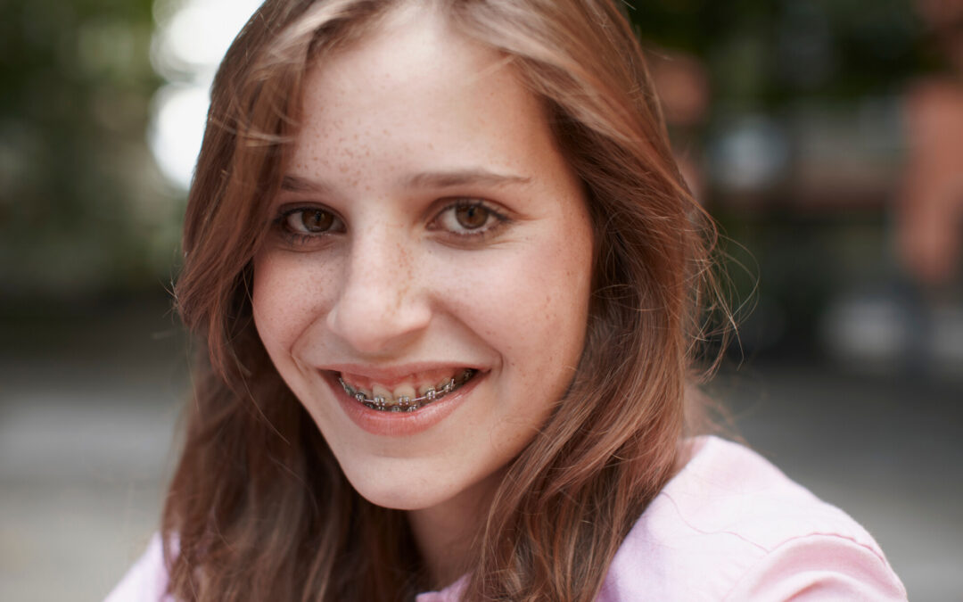 Braces for Kids: What Are the Options?