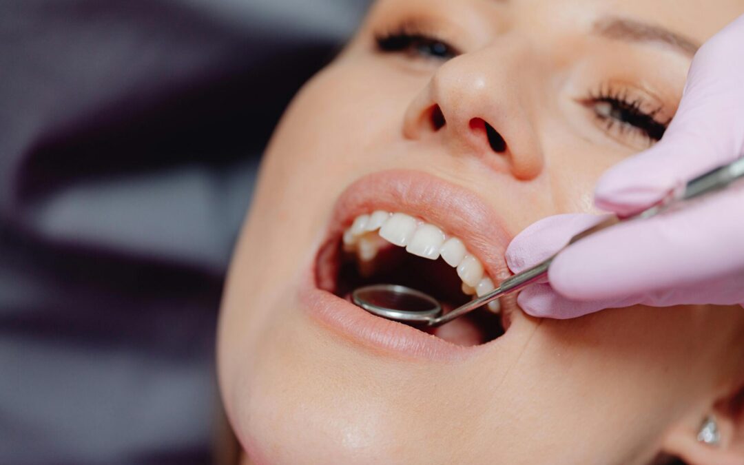 diy invisalign