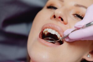 diy invisalign